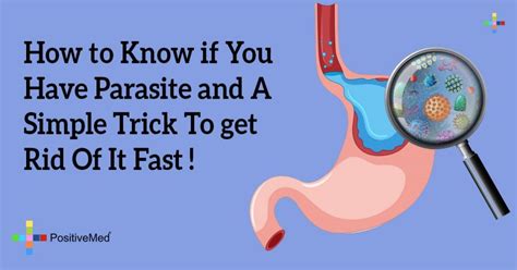 How can I tell if I have a parasite?