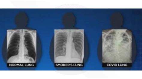 How can I tell if my lungs are damaged?