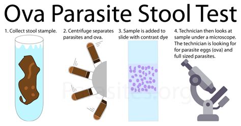 How can I test myself for parasites?