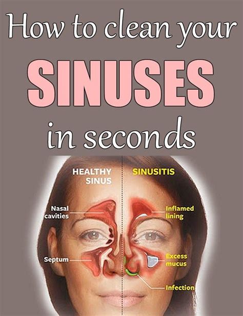 How can I unclog my sinuses fast?