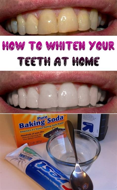 How can I whiten my teeth at home?