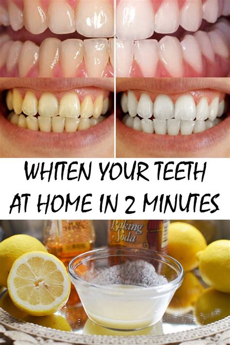 How can I whiten my teeth in 2 minutes?