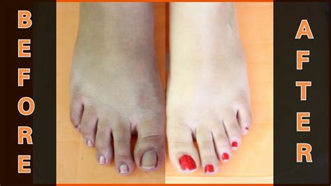 How can I whiten the bottom of my feet?