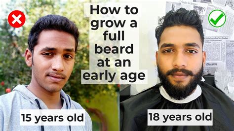 How can a 15 year old grow a beard?