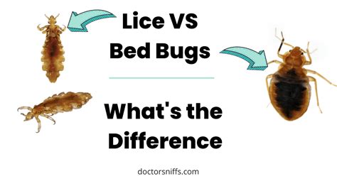 How can you tell the difference between lice and mites?