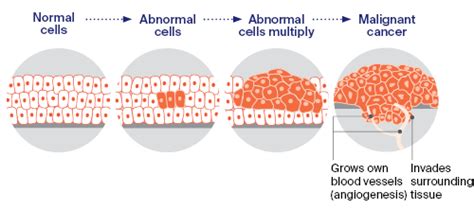 How cancer starts?