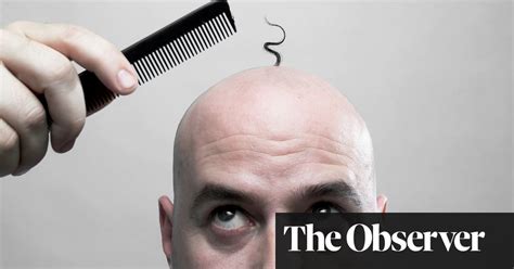 How close are we to curing baldness?