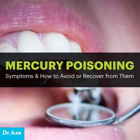 How common is mercury poisoning?