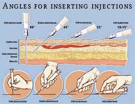 How deep should the needle go when injecting?