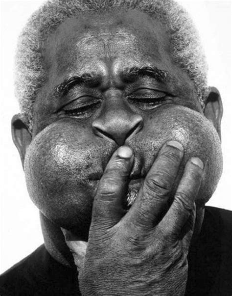 How did Dizzy Gillespie's cheeks get so big?