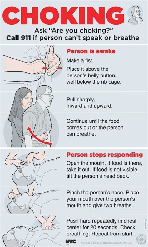 How did people stop choking before Heimlich?