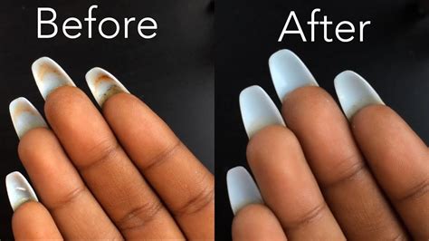 How dirty are acrylic nails?