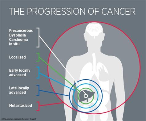 How do Cancers work?