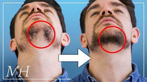 How do I fix my neck beard?