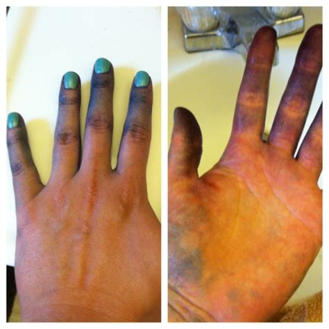 How do I get dye off my hands?