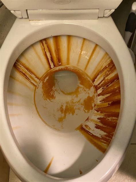 How do I get rid of dark brown stains in my toilet bowl?