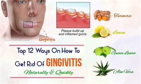 How do I get rid of gingivitis ASAP?