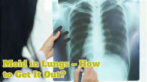 How do I know if I have Mould in my lungs?