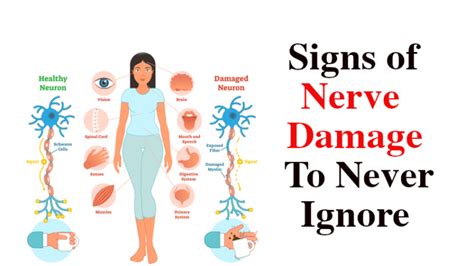 How do I know if I have nerve damage?