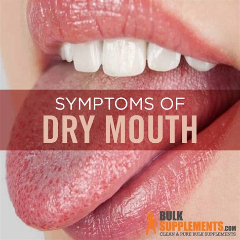 How do I know if my dry mouth is serious?