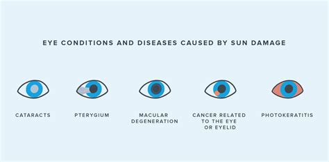 How do I know if my eyes are damaged?