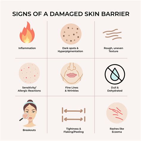 How do I know if my moisture barrier is healthy?