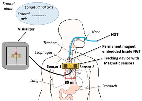 How do I monitor NGT?