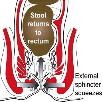 How do I relax my sphincter to poop?