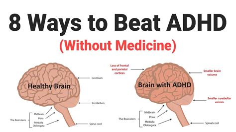 How do I stop ADHD brain overthinking?