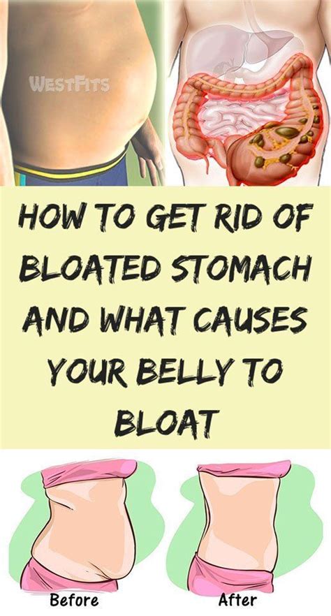 How do I stop bloating ASAP?