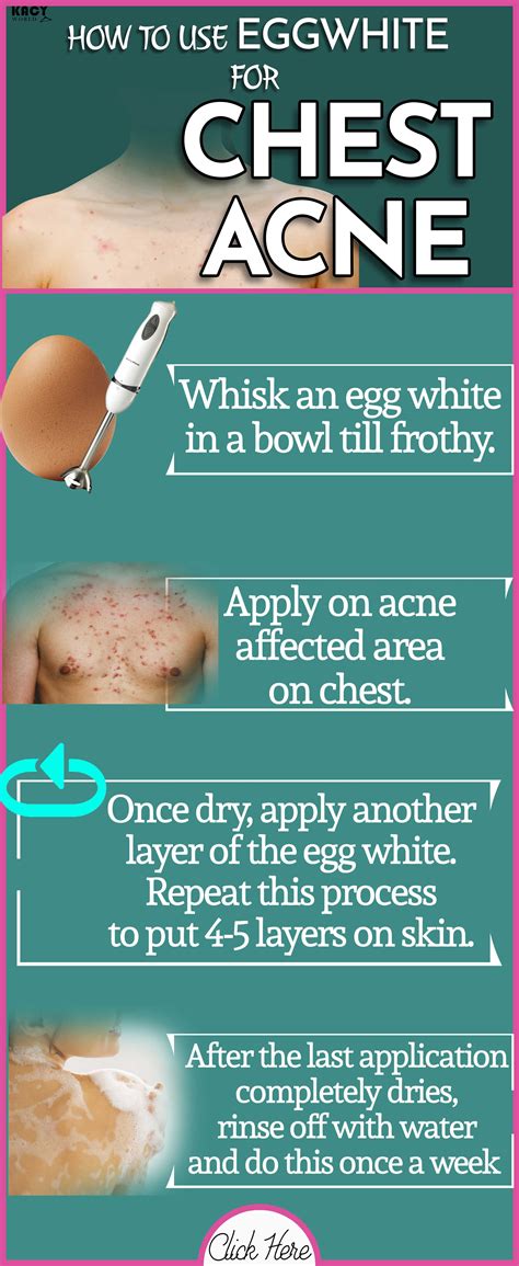 How do I stop chest acne?