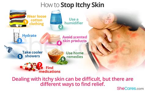 How do I stop dermatitis itching at night?