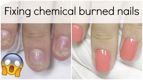 How do I stop my acrylic nails from burning?