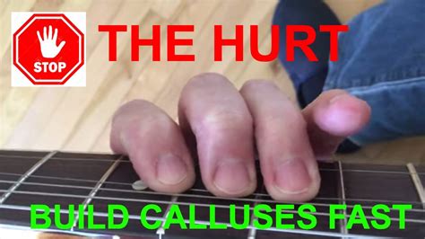 How do I stop my guitar calluses from hurting?