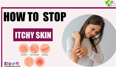 How do I stop my skin from itching ASAP?