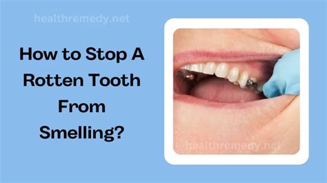 How do I stop my teeth from smelling rotten?