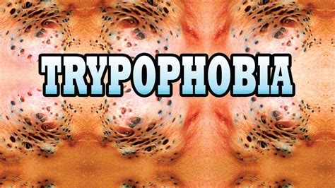 How do I stop thinking about trypophobia?