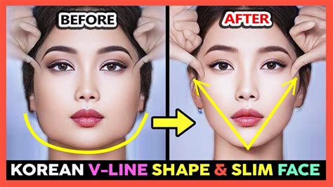 How do Koreans get V shaped face?