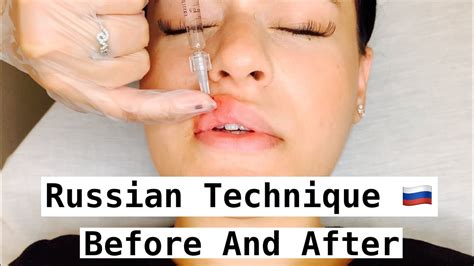 How do Russian lips work?