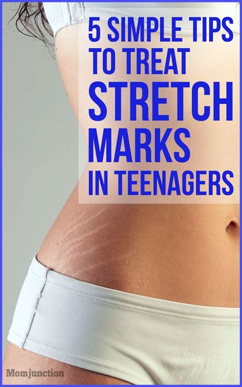 How do celebrities get rid of their stretch marks?