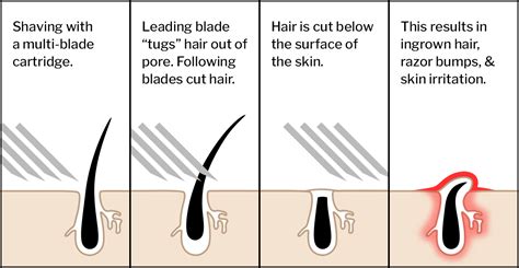 How do circular razors work?