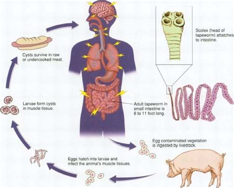 How do humans get pork tapeworm?