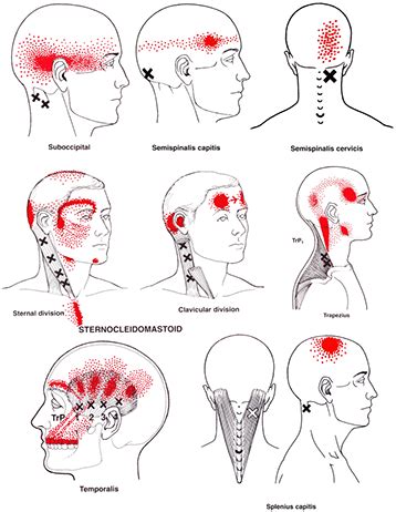 How do massage therapists know where tension is?