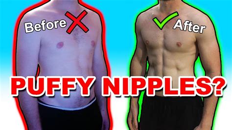 How do men fix flat nipples?