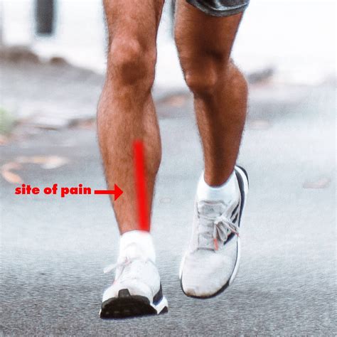 How do you break up shin splints?