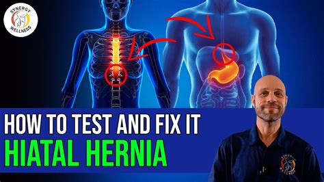 How do you check yourself for a hiatal hernia?