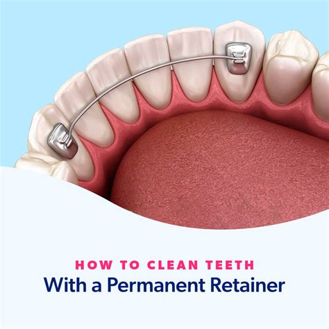 How do you clean your gums with a permanent retainer?