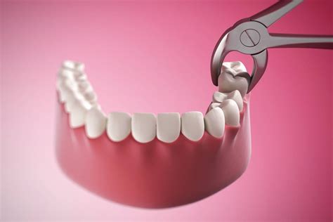 How do you clean your mouth after a tooth extraction?