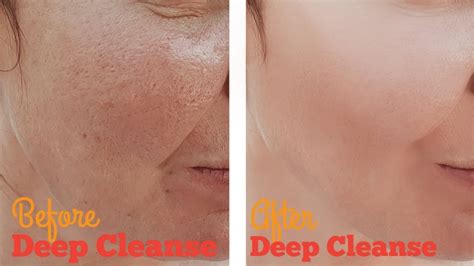How do you deep clean your pores?