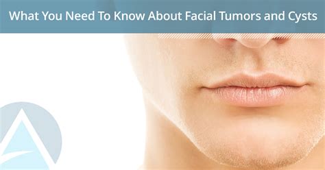 How do you detect a facial tumor?